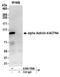 ACTN4 antibody, A304-768A, Bethyl Labs, Immunoprecipitation image 
