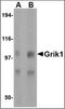 Glutamate Ionotropic Receptor Kainate Type Subunit 1 antibody, orb88375, Biorbyt, Western Blot image 