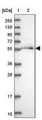 Mannosyl (Alpha-1,6-)-Glycoprotein Beta-1,2-N-Acetylglucosaminyltransferase antibody, PA5-60484, Invitrogen Antibodies, Western Blot image 