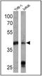 HLA class I histocompatibility antigen, A-3 alpha chain antibody, MA5-13582, Invitrogen Antibodies, Western Blot image 