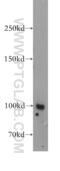 Membrane Metalloendopeptidase antibody, 18008-1-AP, Proteintech Group, Western Blot image 