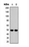 Interleukin 13 Receptor Subunit Alpha 1 antibody, orb393329, Biorbyt, Western Blot image 