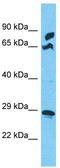 Mitochondrial Ribosomal Protein S5 antibody, TA337440, Origene, Western Blot image 
