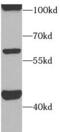Activin A Receptor Type 1C antibody, FNab00130, FineTest, Western Blot image 