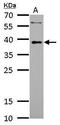 LIM Domain Binding 3 antibody, GTX115593, GeneTex, Western Blot image 