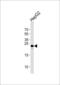 Metabolism Of Cobalamin Associated B antibody, 61-017, ProSci, Western Blot image 