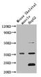 Mitochondrially Encoded NADH:Ubiquinone Oxidoreductase Core Subunit 1 antibody, CSB-PA015076LA01HU, Cusabio, Western Blot image 