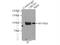 Leucine Rich Repeats And Calponin Homology Domain Containing 1 antibody, 25017-1-AP, Proteintech Group, Immunoprecipitation image 