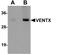 VENT Homeobox antibody, NBP1-77192, Novus Biologicals, Western Blot image 