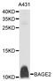 BAGE Family Member 2 antibody, STJ112198, St John
