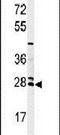 Probable N-acetyltransferase 8 antibody, PA5-24879, Invitrogen Antibodies, Western Blot image 