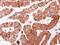 hScrib antibody, PA5-28628, Invitrogen Antibodies, Immunohistochemistry paraffin image 