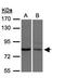 Xenotropic And Polytropic Retrovirus Receptor 1 antibody, GTX108158, GeneTex, Western Blot image 