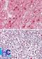 Transcription Factor 19 antibody, NBP2-24586, Novus Biologicals, Immunohistochemistry paraffin image 