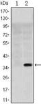 Solute Carrier Family 22 Member 1 antibody, NBP1-51684, Novus Biologicals, Western Blot image 