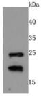 Rac Family Small GTPase 1 antibody, NBP2-67091, Novus Biologicals, Western Blot image 