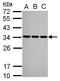 Small Nuclear Ribonucleoprotein Polypeptide A antibody, GTX101664, GeneTex, Western Blot image 