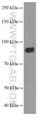 Deleted in bladder cancer protein 1 antibody, 60336-1-Ig, Proteintech Group, Western Blot image 