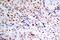 RB Transcriptional Corepressor 1 antibody, LS-C177945, Lifespan Biosciences, Immunohistochemistry paraffin image 