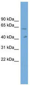 Solute Carrier Family 22 Member 10 antibody, TA334131, Origene, Western Blot image 