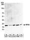 Ribosomal Protein S5 antibody, A304-011A, Bethyl Labs, Western Blot image 