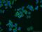 Transient Receptor Potential Cation Channel Subfamily C Member 1 antibody, 19482-1-AP, Proteintech Group, Immunofluorescence image 