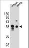 Dipeptidase 3 antibody, LS-C167510, Lifespan Biosciences, Western Blot image 
