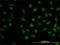 Dihydrofolate Reductase antibody, H00001719-M01, Novus Biologicals, Immunofluorescence image 