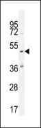 Katanin Catalytic Subunit A1 Like 1 antibody, LS-C165400, Lifespan Biosciences, Western Blot image 