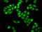 Pre-mRNA-processing-splicing factor 8 antibody, LS-C671461, Lifespan Biosciences, Immunofluorescence image 