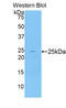 Aminopeptidase Puromycin Sensitive antibody, LS-C299767, Lifespan Biosciences, Western Blot image 