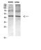 Opsin-3 antibody, A09353, Boster Biological Technology, Western Blot image 
