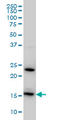 Ribosomal Protein S17 antibody, LS-B4407, Lifespan Biosciences, Western Blot image 