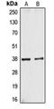Cysteinyl Leukotriene Receptor 1 antibody, orb215016, Biorbyt, Western Blot image 