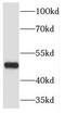 Jumonji Domain Containing 4 antibody, FNab04441, FineTest, Western Blot image 