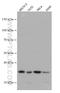 V-Set Domain Containing T Cell Activation Inhibitor 1 antibody, 66817-1-Ig, Proteintech Group, Western Blot image 