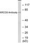 70 kDa subunit of Ku antigen antibody, EKC1613, Boster Biological Technology, Western Blot image 