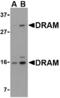 DNA Damage Regulated Autophagy Modulator 1 antibody, AHP1694, Bio-Rad (formerly AbD Serotec) , Immunohistochemistry paraffin image 