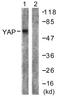 Yes Associated Protein 1 antibody, LS-B9238, Lifespan Biosciences, Western Blot image 