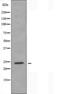 Ribosomal Protein L10 antibody, orb225698, Biorbyt, Western Blot image 