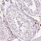 Zinc finger protein 639 antibody, HPA052163, Atlas Antibodies, Immunohistochemistry paraffin image 