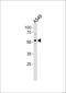 Zinc finger protein with KRAB and SCAN domains 4 antibody, PA5-35208, Invitrogen Antibodies, Western Blot image 