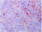 CD120b antibody, BM4054B, Origene, Immunohistochemistry frozen image 