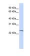 Putative protein SSX6 antibody, orb324636, Biorbyt, Western Blot image 