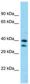 Protein salvador homolog 1 antibody, TA344717, Origene, Western Blot image 