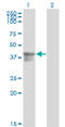 Serpin Family B Member 3 antibody, LS-C198149, Lifespan Biosciences, Western Blot image 