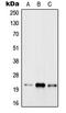 RAB31, Member RAS Oncogene Family antibody, GTX55929, GeneTex, Western Blot image 