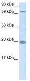 Rhox-11 antibody, TA331440, Origene, Western Blot image 