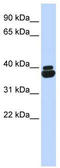 Orthopedia Homeobox antibody, TA337264, Origene, Western Blot image 