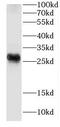 Cysteine Rich Protein 2 antibody, FNab01977, FineTest, Western Blot image 